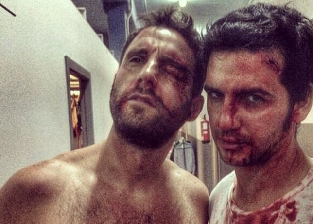 Fran Perea y Dani Rovira, ensangrentados y apaleados