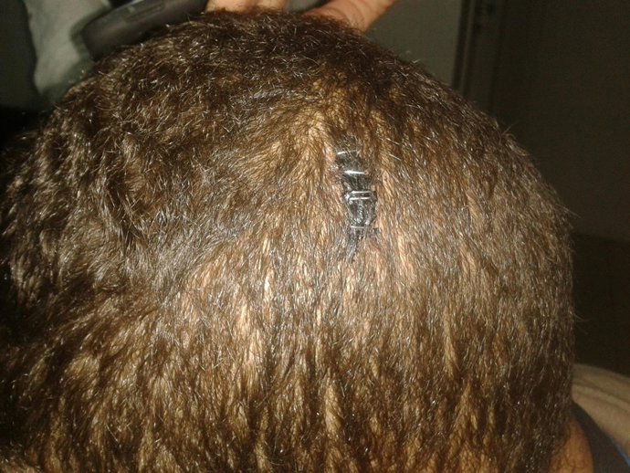 Un interno denuncia agresiones en la represión del intento de fuga del CIE