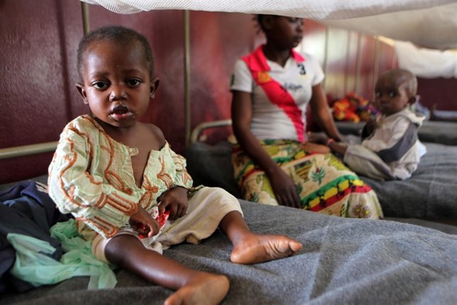 Un niño con comida terapéutica en un hospital de Bangui