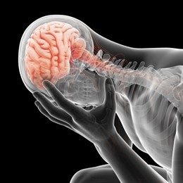 Ictus, derrame cerebral o infarto cerebral