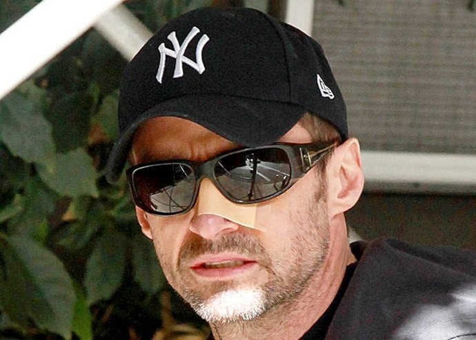 Por tercera vez Hugh Jackman se somete operación de cancer de piel 