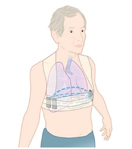 Chaleco que monotoriza a pacientes con insuficiencia cardiaca