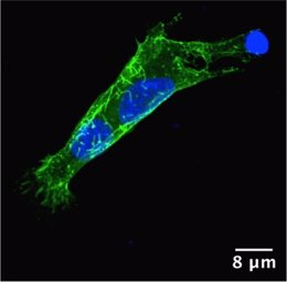 Proteína PSTPIP1