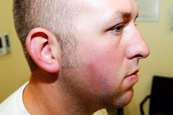 El agente Darren Wilson tras la agresión de Michael Brown.