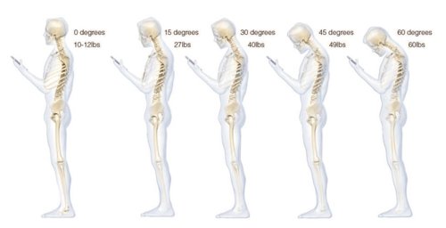 Desviación espalda por culpa del 'smartphone'