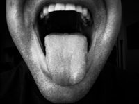 Boca seca: sin la valiosa saliva