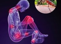 ¿Por qué se llama chikungunya al virus que afecta a las Américas?