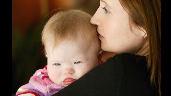 Una madre con su hija Síndrome de Down