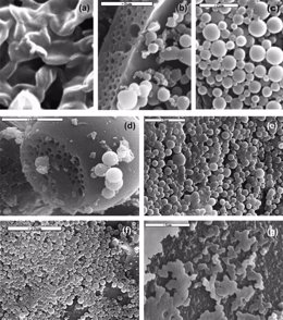 Imagen de las micro cápsulas de inulina, de tamaño microscópico