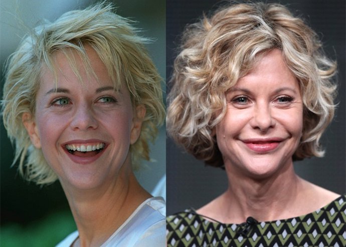 Uma Thurman, Renée Zellwegger... ¿Qué más actrices se pasaron con la cirugia?