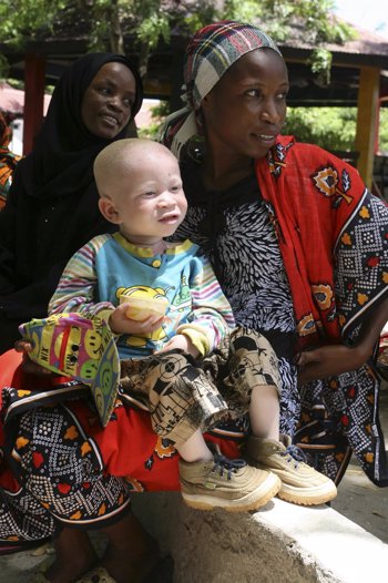 Una madre con su hijo albino en Dar es Salaam (Tan