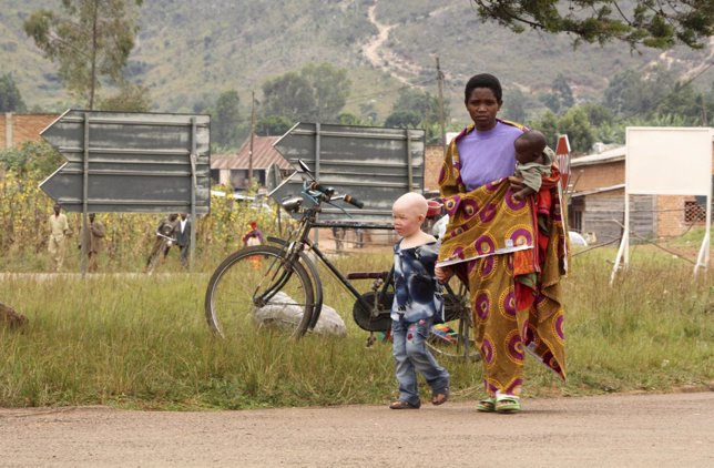 Una mujer camina junto a su hijo albino en Burundi