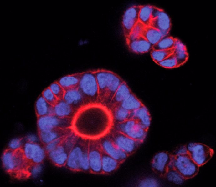 Científicos del IRB logran predecir la metástasis del cáncer colon