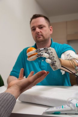 Primer amputado en el mundo que puede sentir con una mano biónica