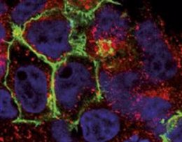 Detección de los receptores CXCR4 (verde) en células embrionarias de riñón