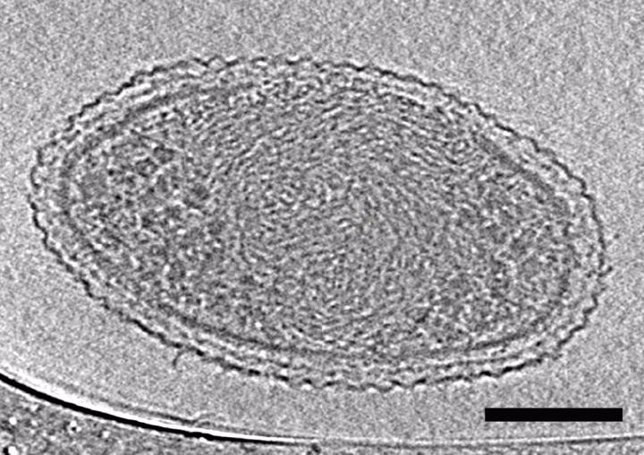 Bacterias ultra-pequeñas