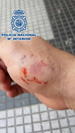 Agresión a un agente del CNP