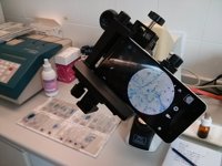 La tuberculosis se podrá detectar en un videojuego