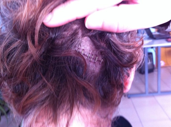 Ndp "Agresión En Sevilla A Una Mujer Transexual"