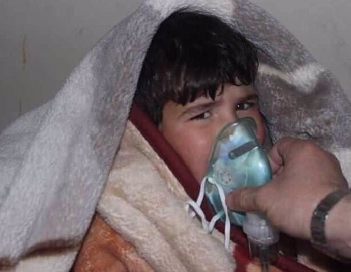 Un niño afectado por un ataque de gas de cloro