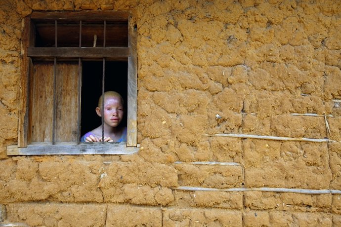 Exposición fotográfica en Madrid sobre los albinos en Tanzania