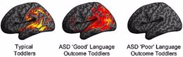 Imágenes del cerebro explican diferencias desarrollo niño autismo
