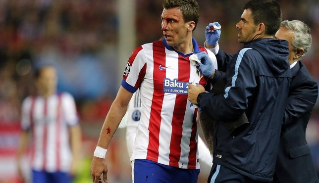 Mario Mandzukic sangrando en el Atlético - Real Madrid