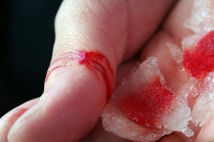 Afectado por hemofilia