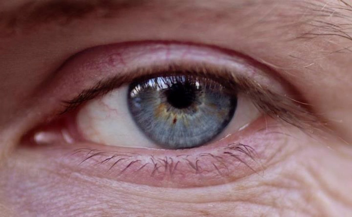 Los vasos sanguíneos del ojo de enfermedades