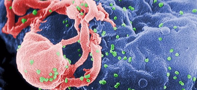 virus del sida, VIH