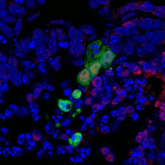 Células madre para superar obstáculos en medicina regenerativa