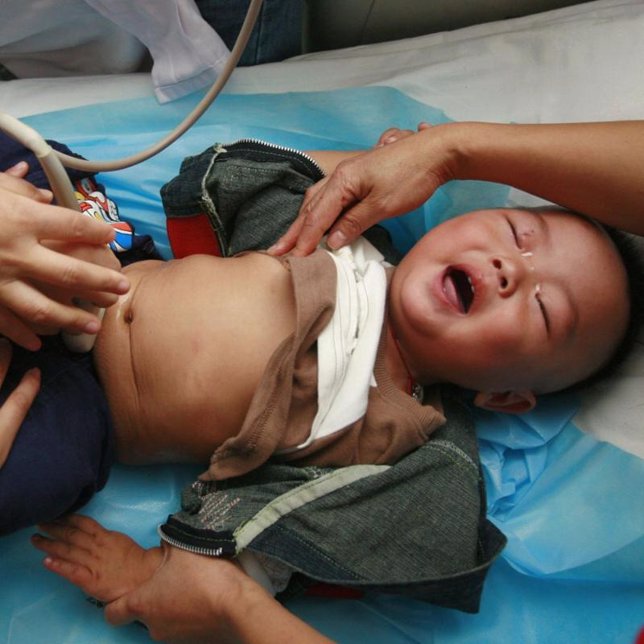 Bebé chino enfermo por la leche contaminada