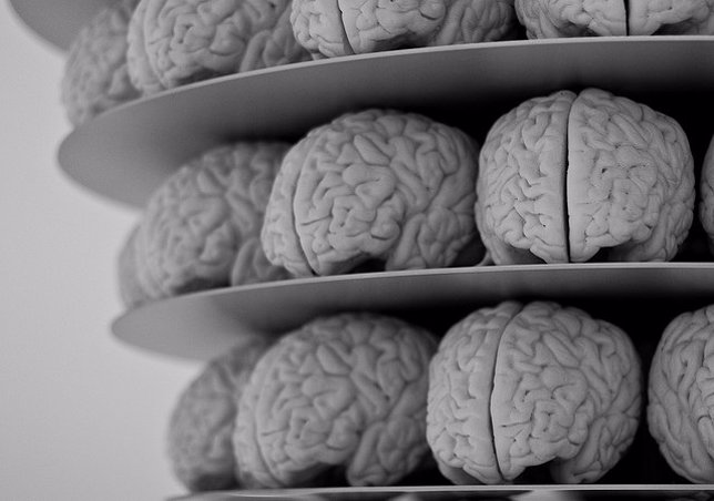 Cerebro, Alzheimer