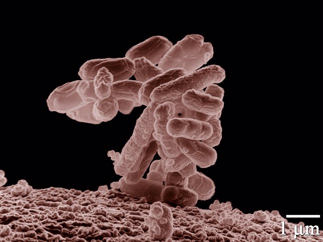 E.Coli /Escherichia Coli