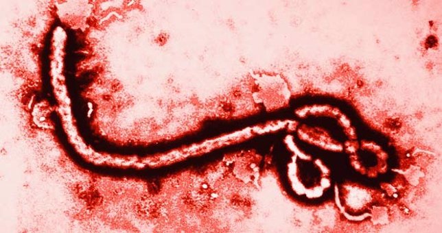 Célula del ébola