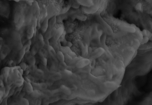 Posibles restos de globulos rojos fósiles