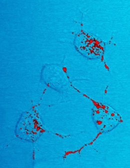 Células nerviosas de ratón con priones (en rojo)