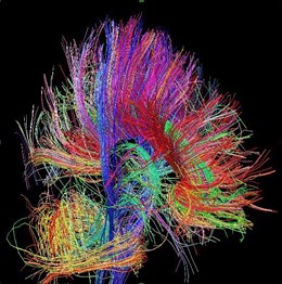 Arquitectura de las fibras de materia blanca