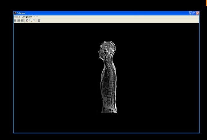 Software para estudiar la columna