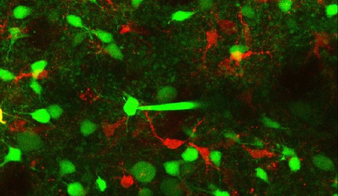 Neuronas y astrocitos
