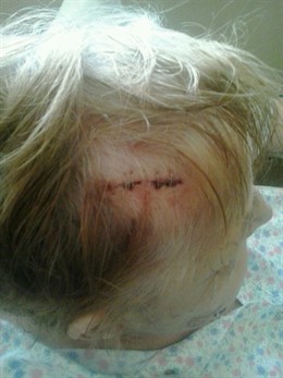 Una de las consecuencias del ataque