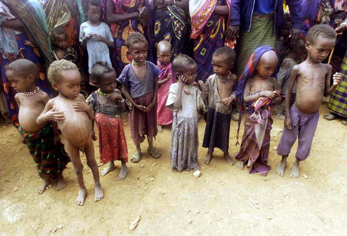 Niños etíopes desnutridos