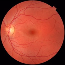 El pigmento macular se encuentra en la retina.