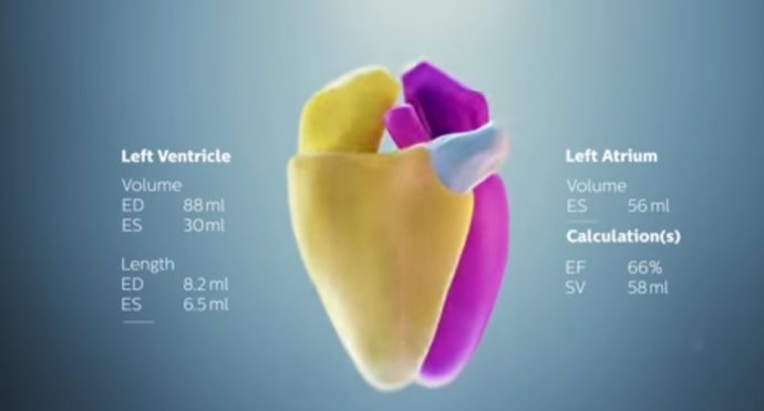 Extracto del vídeo promocional de 'HeartModel'