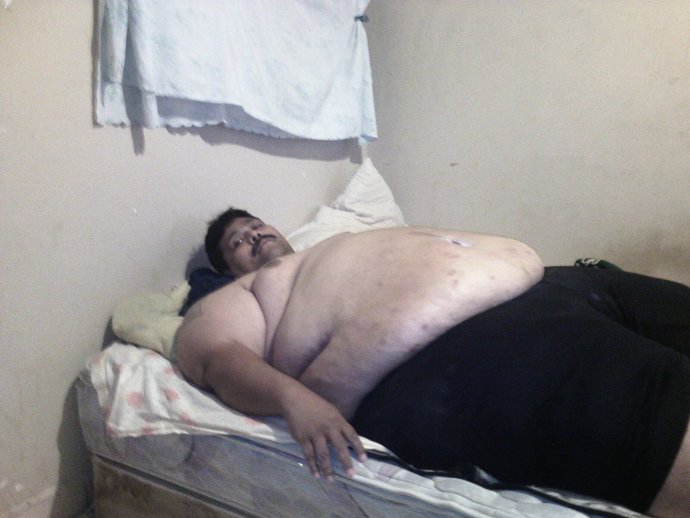 Andrés Moreno - El hombre más obeso del mundo actualmente vivo