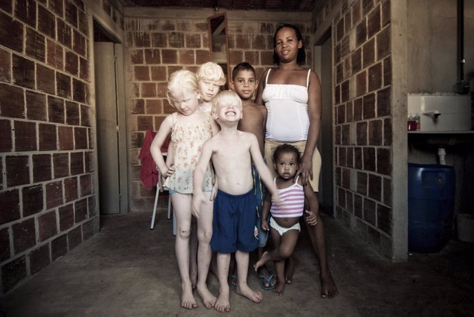 Familia con varios hijos albinos en Brasil