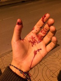 Agredidos al grito de "mariquitas" cuando salían de una disco