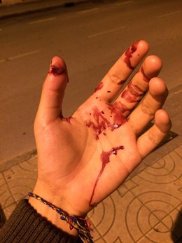 La mano de uno de los agredidos