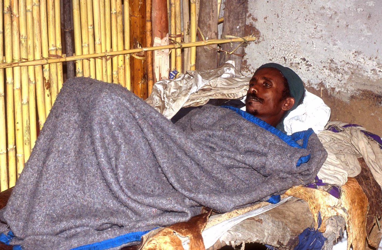 Paciente Con Malaria En Etiopia