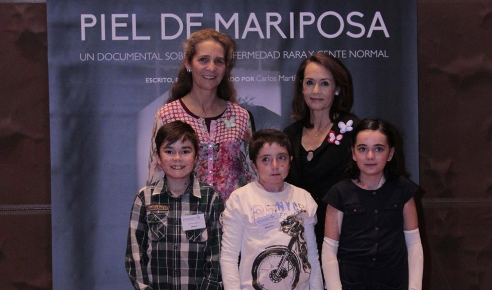 La infanta doña Elena con niños afectados por la enfermedad de mariposa